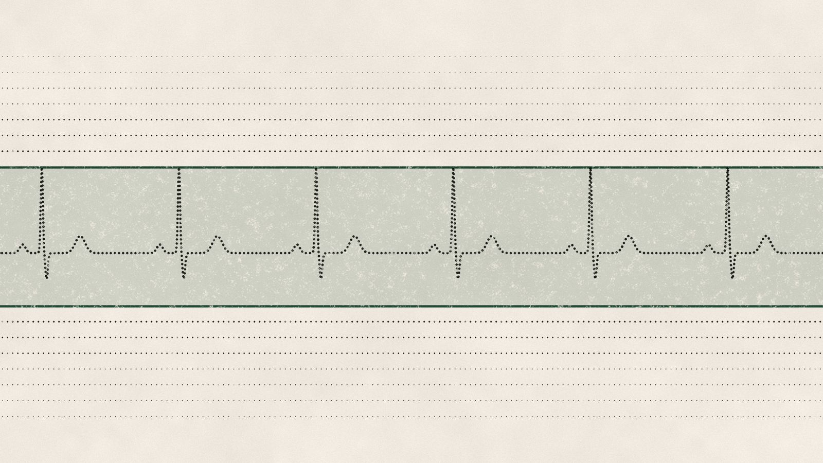 A pulse traced in dots inside a pale green band bounded by two green lines, with faint dotted lines above and below.